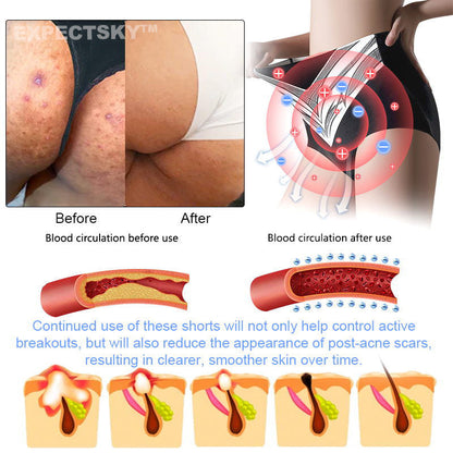 EXPECTSKY®Medical Grade Titanium Fiber Tourmaline Shaping Shorts🎁