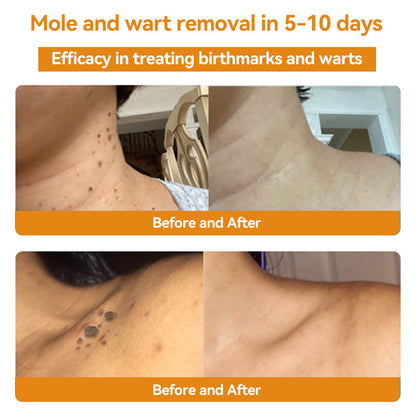 Turonu™ Bee Venom Skin Treatment Cream British Association of Dermatologists (BAD) Approved(Helping with acne, wart, rosacea, psoriasis, age spots, eczema, and reducing the appearance of stretch marks)🏵️