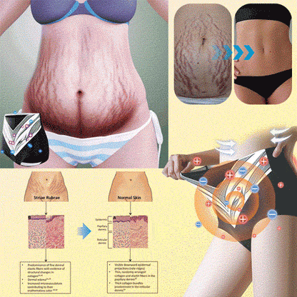 EXPECTSKY®Medical Grade Titanium Fiber Tourmaline Shaping Shorts🎁