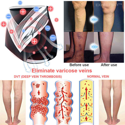EXPECTSKY®Medical Grade Titanium Fiber Tourmaline Shaping Shorts🎁